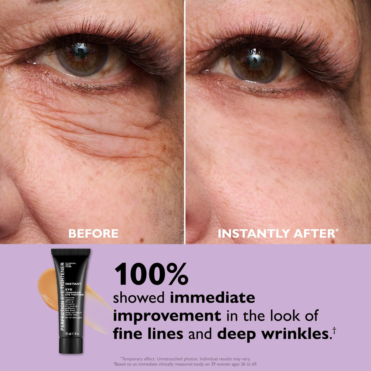 Final 3 Hours: 60%OFF🔥 Instant Eye Tightener Easy-Wear Formula With Brush Free!