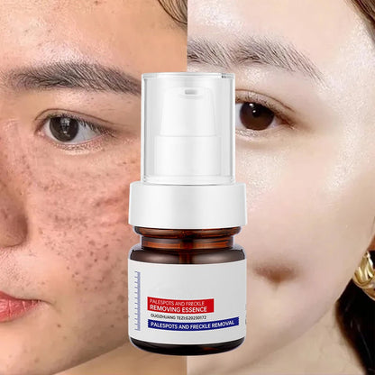 🔥FLASH SALE：⚡5-second brightening rescue: Dark spots disappear, blemishes fade, and skin becomes radiant! Vitamin C Whitening Freckles ESSENCE