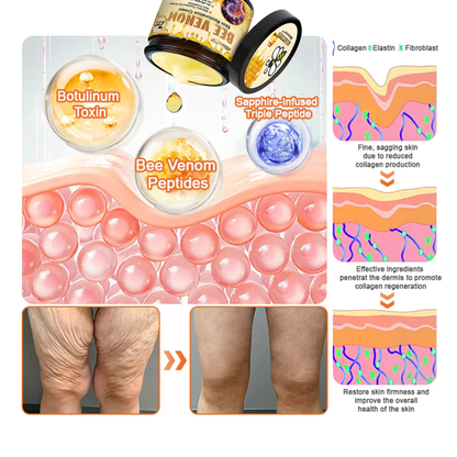 ✨✨Skavix™ Bee venom Comprehensive Cream — 🔥Limited Time 80% OFF🔥