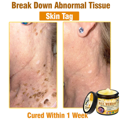 ✨✨Skavix™ Bee venom Comprehensive Cream — 🔥Limited Time 80% OFF🔥