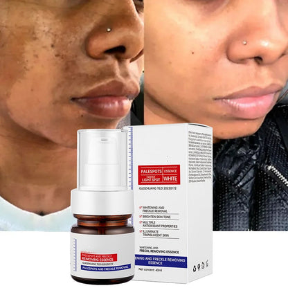 🔥FLASH SALE：⚡5-second brightening rescue: Dark spots disappear, blemishes fade, and skin becomes radiant! Vitamin C Whitening Freckles ESSENCE