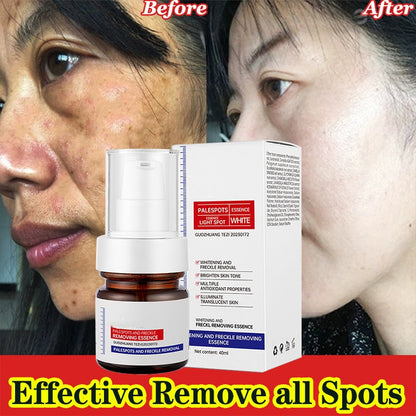 🔥FLASH SALE：⚡5-second brightening rescue: Dark spots disappear, blemishes fade, and skin becomes radiant! Vitamin C Whitening Freckles ESSENCE